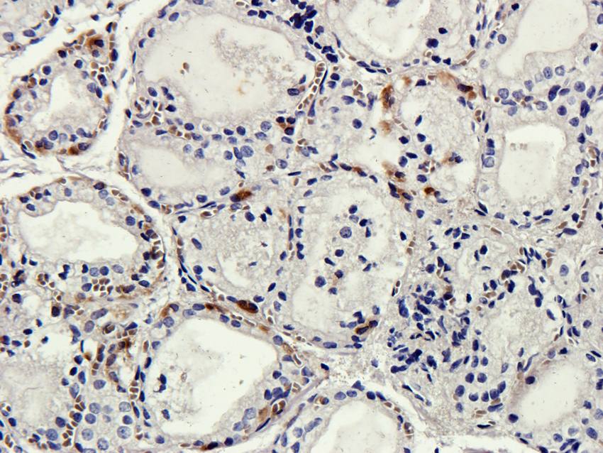 B7-H6 Rabbit Polyclonal Antibody