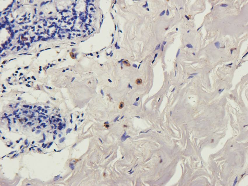 B7-H6 Rabbit Polyclonal Antibody