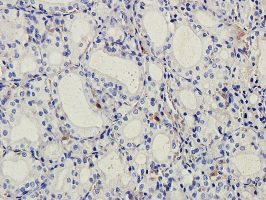 B7-H6 Rabbit Polyclonal Antibody