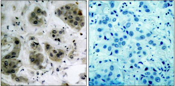 Akt (Ab-473) Antibody