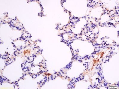 Band3 Rabbit Polyclonal Antibody