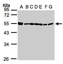 DExD-box helicase 39B|DExD-box helicase 39A Antibody