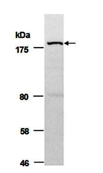 BAZ1b (C) Antibody, Rabbit Polyclonal