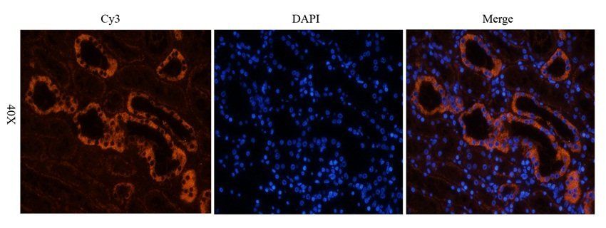 BAZ2A Rabbit Polyclonal Antibody