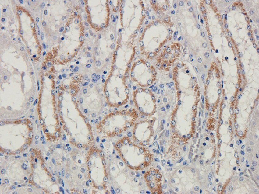 BAZ2A Rabbit Polyclonal Antibody