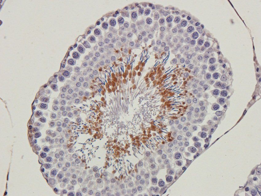 BAZ2A Rabbit Polyclonal Antibody