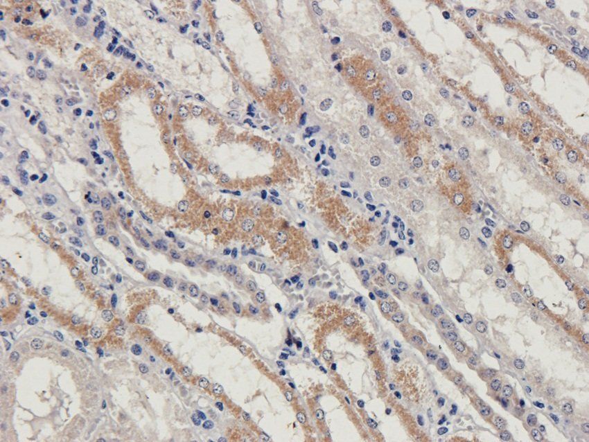 BAZ2A Rabbit Polyclonal Antibody