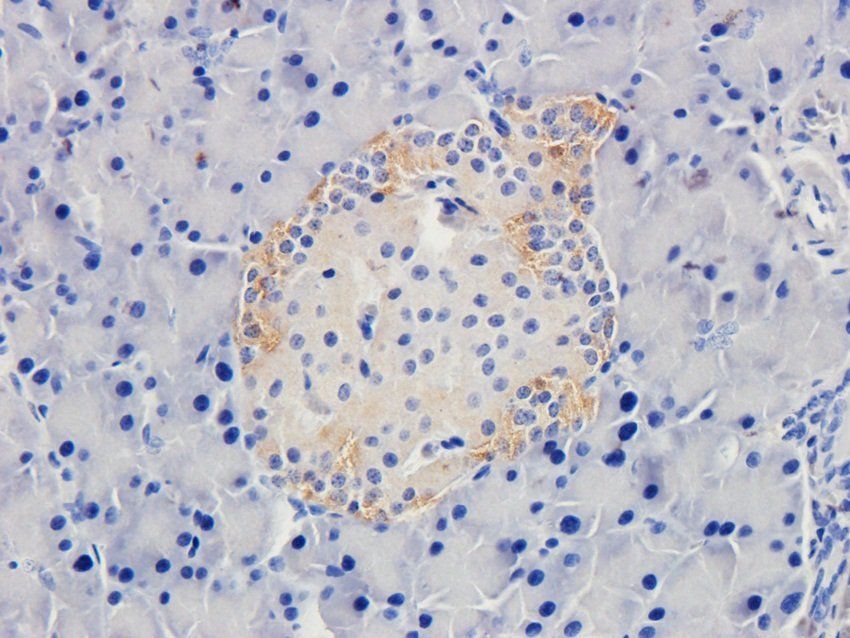 BAZ2A Rabbit Polyclonal Antibody