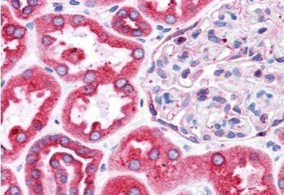 BCAP31/BAP31 Antibody