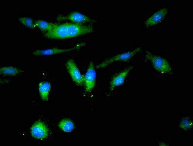 BCHE Antibody