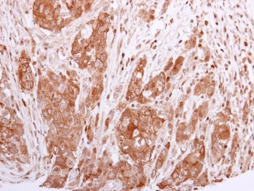 BCL2L12 Rabbit Polyclonal Antibody