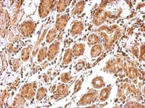 BCL2L12 Rabbit Polyclonal Antibody