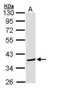 BCL2L12 Rabbit Polyclonal Antibody
