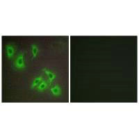 BCL2L2 Antibody