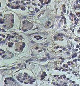 BCL2L2 Rabbit Polyclonal Antibody