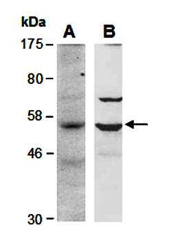 BCL6B (N) Antibody, Rabbit Polyclonal