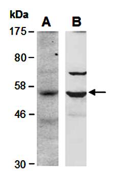 BCL6B (C) Antibody, Rabbit Polyclonal