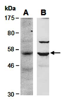 BCL6B (vPairTM) Antibodies