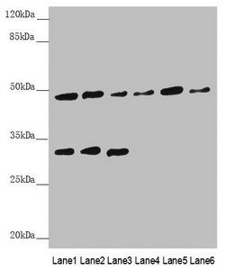 BCS1L Antibody