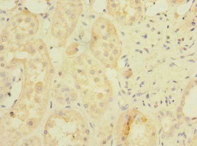 BDH2 Antibody