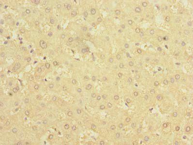 BDH2 Antibody