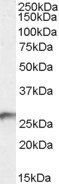 BDH2/DHRS6 (aa 60 to 71) Antibody
