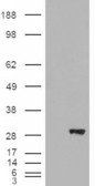 BDH2/DHRS6 (aa 60 to 71) Antibody
