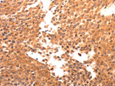 BDKRB2 Antibody
