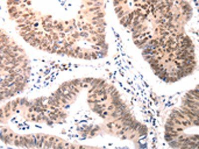 BDKRB2 Antibody