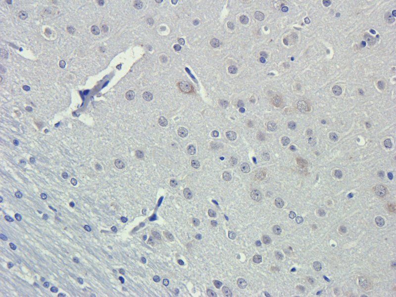 BDNF Rabbit Polyclonal Antibody
