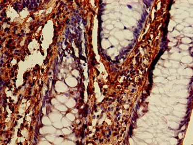 BECN1 Antibody