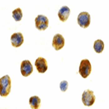 Beclin-1 Antibody