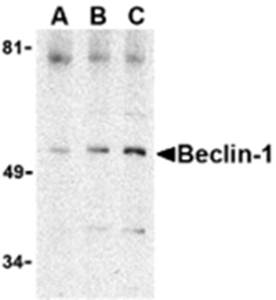 Beclin-1 Antibody