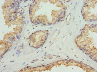 B2M Antibody