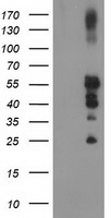 CTNNB1 Antibody