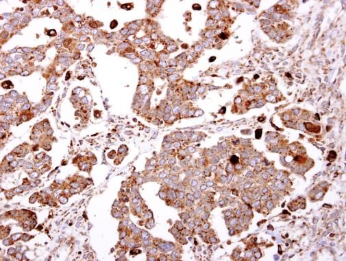 beta-Gal Rabbit Polyclonal Antibody