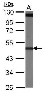 beta Tubulin 4 Rabbit Polyclonal Antibody