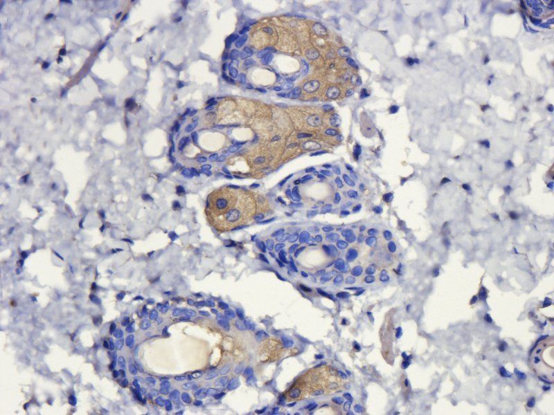 alpha MSH Rabbit Polyclonal Antibody