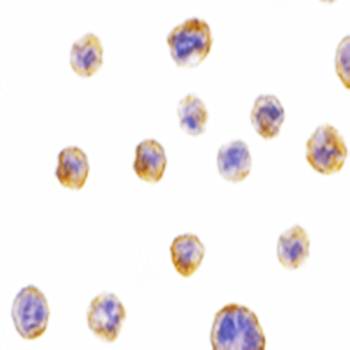 Bif Rabbit Polyclonal Antibody