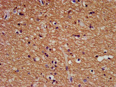 FHIT Antibody