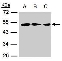RARRES3 antibody [N3C3]
