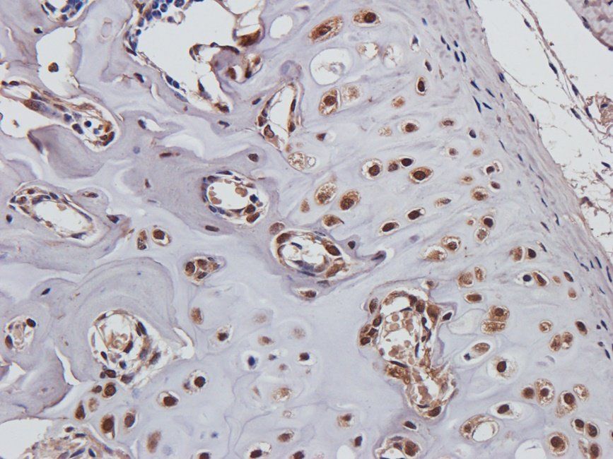 BMP11 Rabbit Polyclonal Antibody