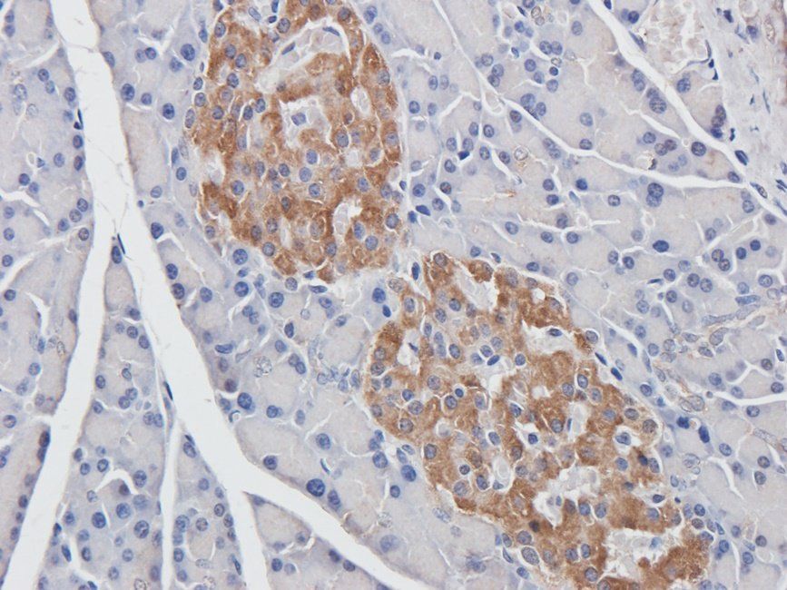 BMP11 Rabbit Polyclonal Antibody