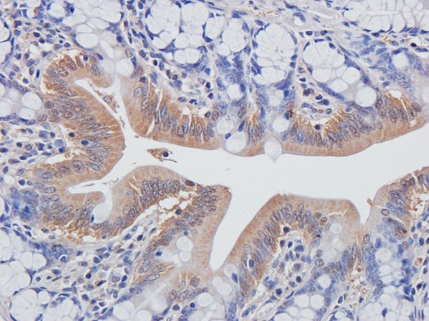 BMP11 Rabbit Polyclonal Antibody