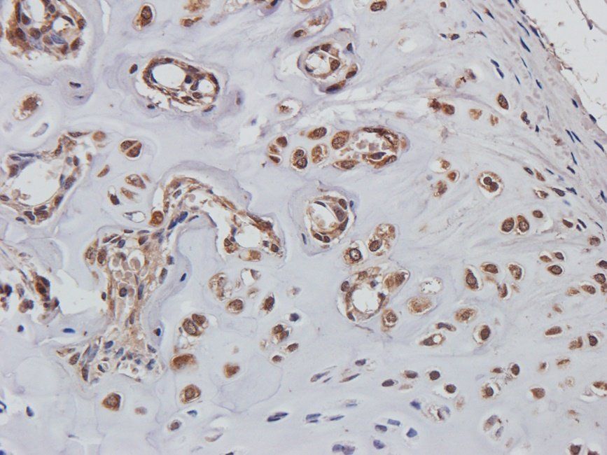 BMP11 Rabbit Polyclonal Antibody