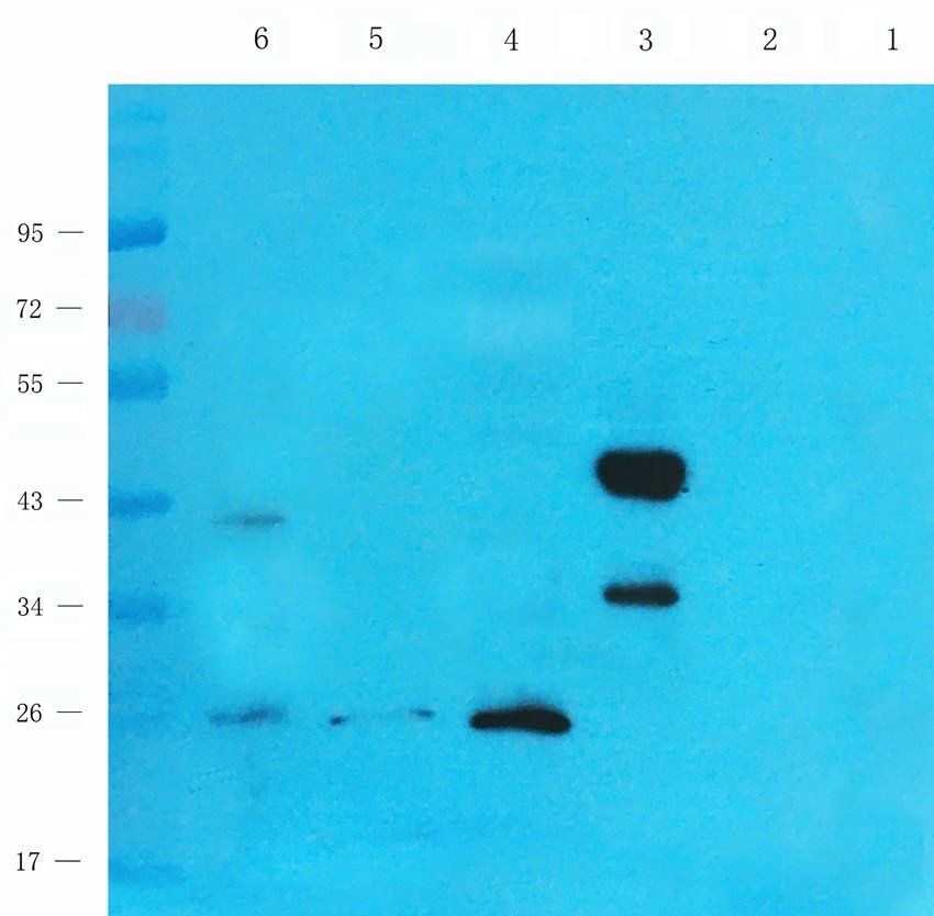 BMP11 Rabbit Polyclonal Antibody