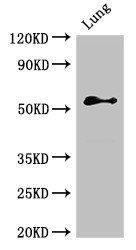 BMPR1B Antibody