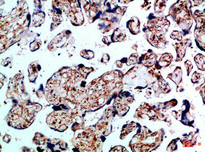 BMPR1B Antibody