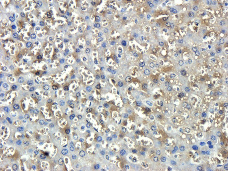 BMPR2 Rabbit Polyclonal Antibody