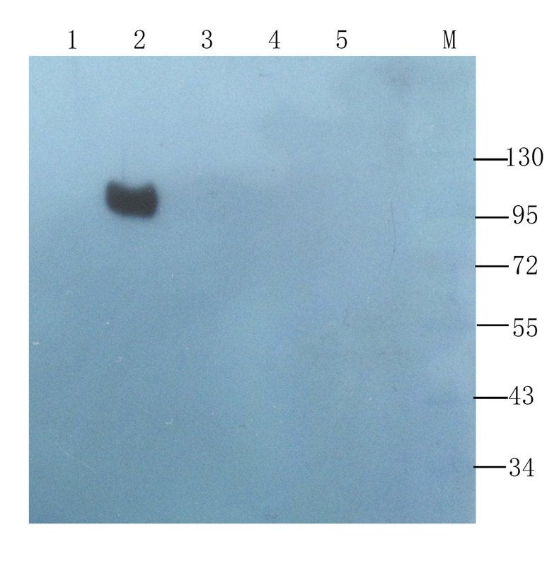 BMPR2 Rabbit Polyclonal Antibody